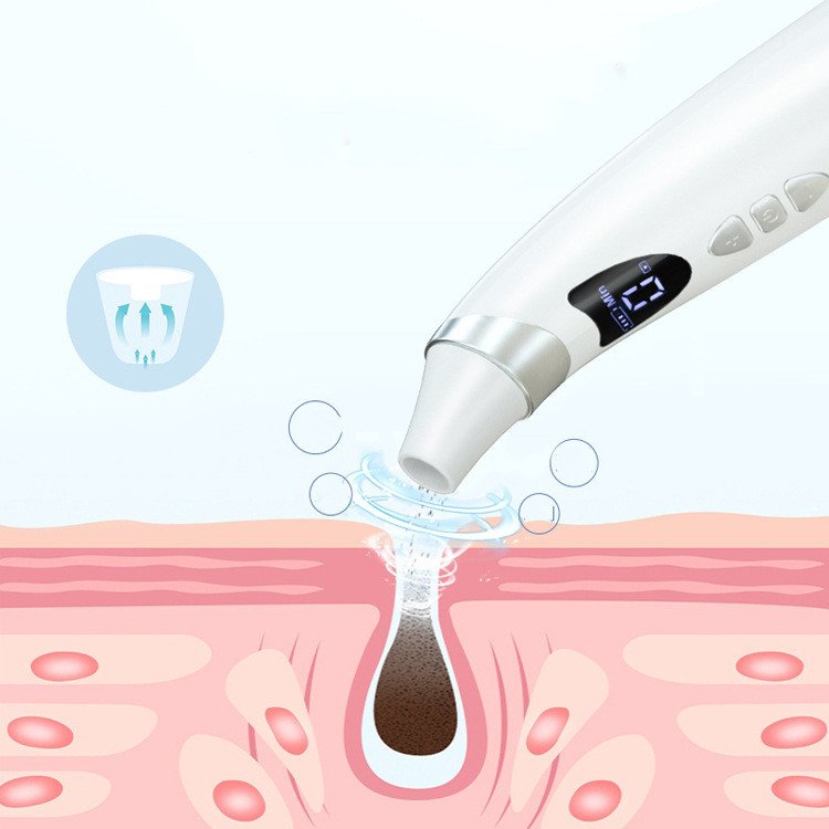 Electric Blackhead Suction Instrument - Image 4