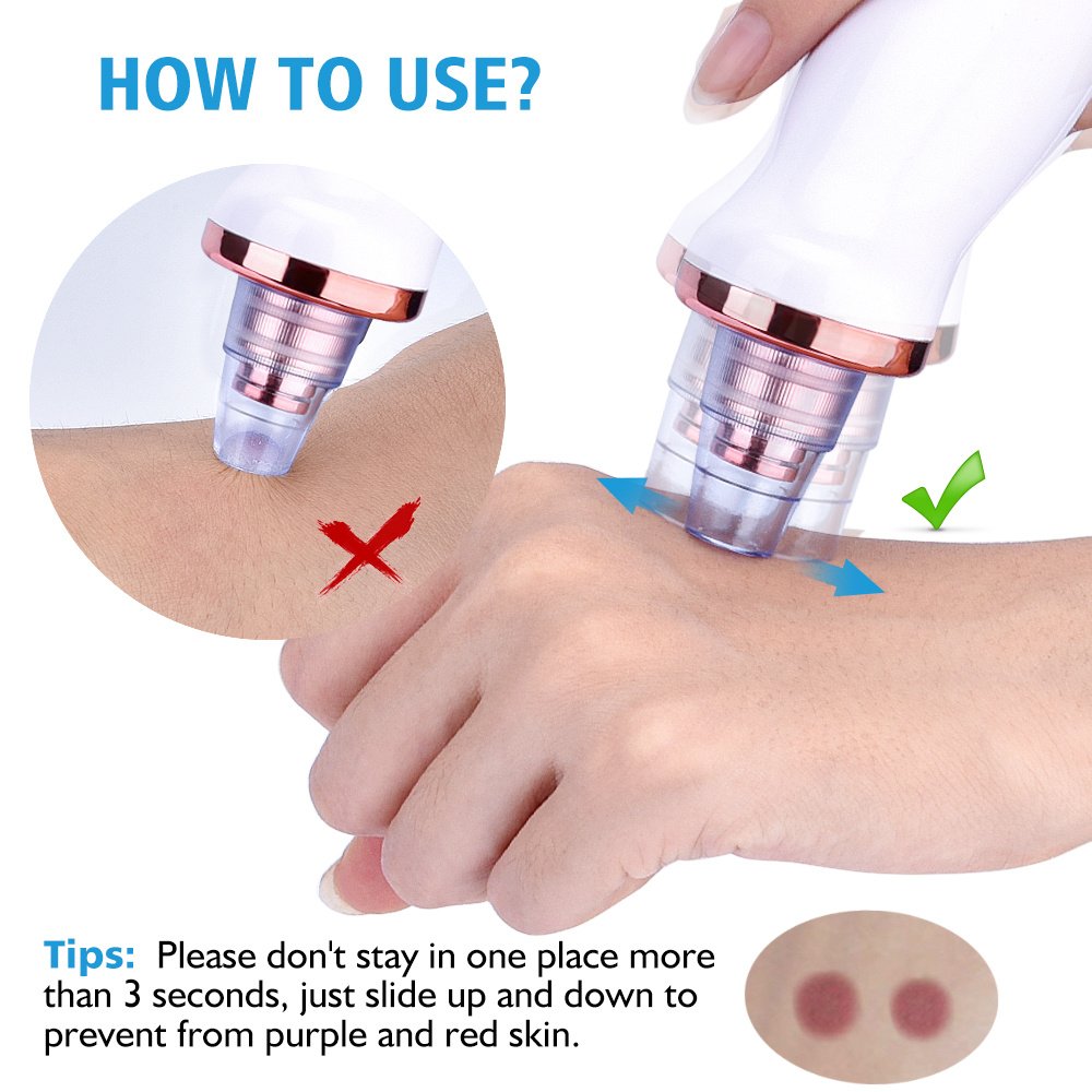 Facial Acne Cleaning Blackhead Suction Instrument - Image 3